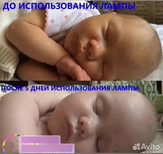 Лампа для фототерапии +билитест (от желтушки)