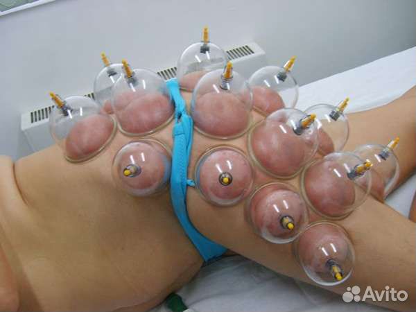 Вакуумные банки с насосом для массажа и хиджамы