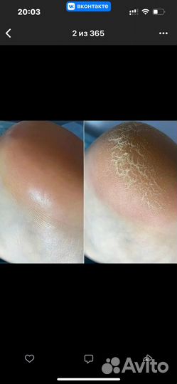 Маникюр,педикюр на Клыкова54