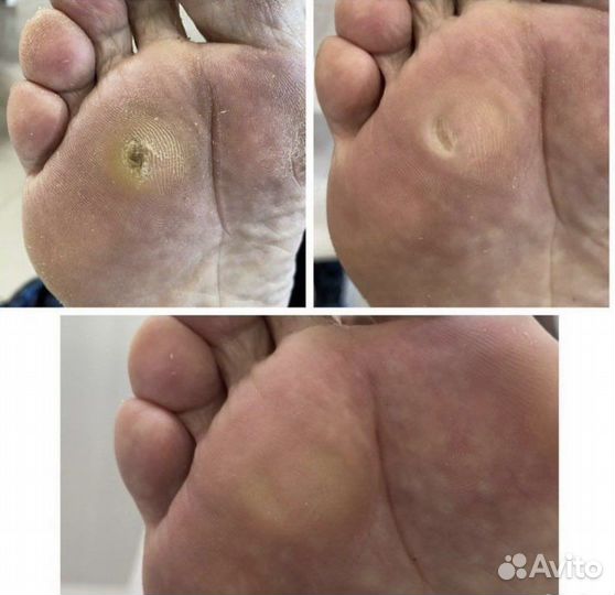 Педикюр, подолог