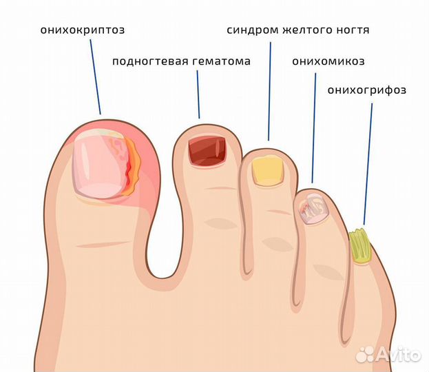 Подолог, услуги подолога