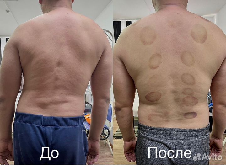 Костоправ