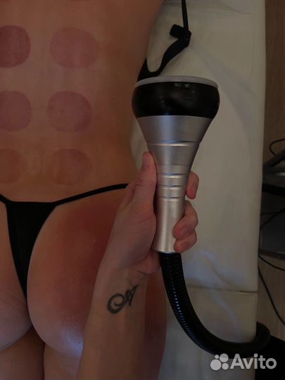 Антицилюлитный массаж