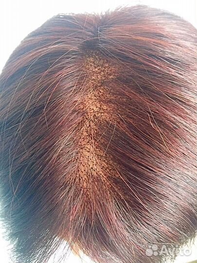 Накладка из натуральных волос RP 04. Цвет разный