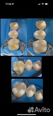 Обучение врач стоматолог объявление продам