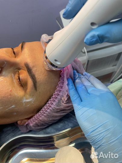 Микроигольчатый РФ лифтинг