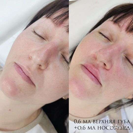 Косметолог с дипломом Архара 6 июля