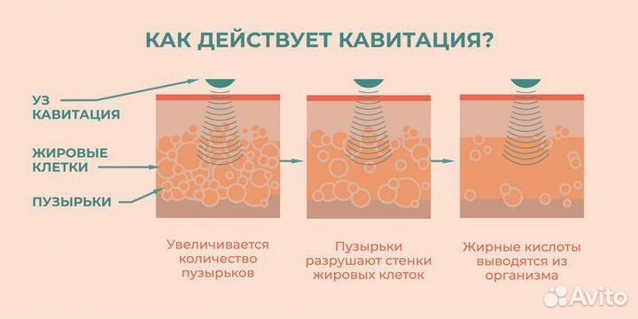 Криолиполиз/Кавитация/RF-лифтинг тела и лица