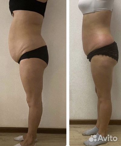 Похудей за 5 дней