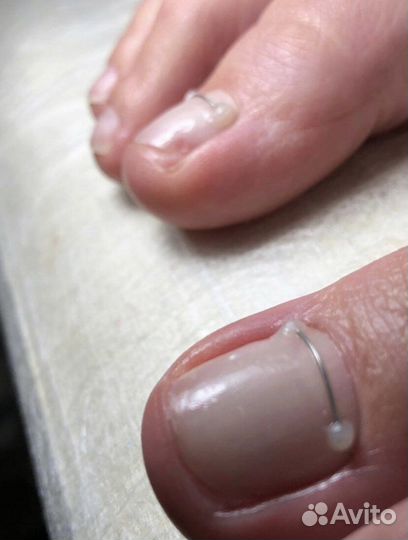 Услуги подолога