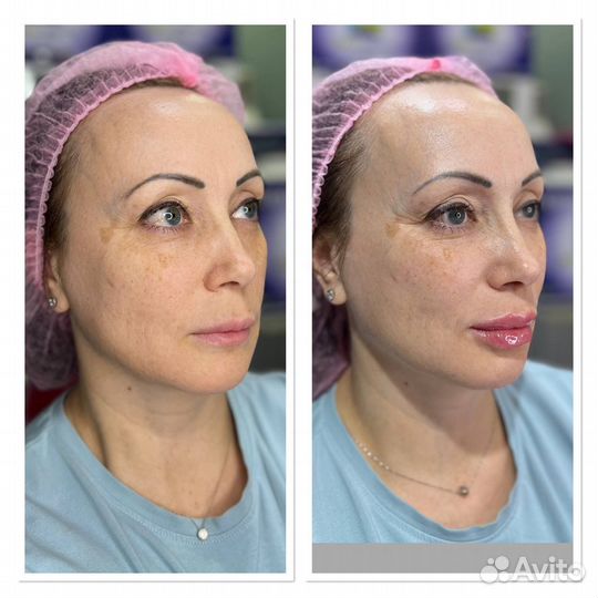 Модель на нити