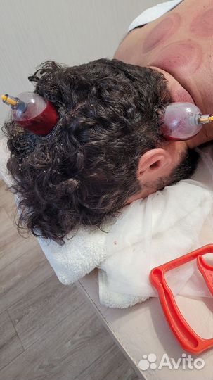 Массаж баночный оздоровительный