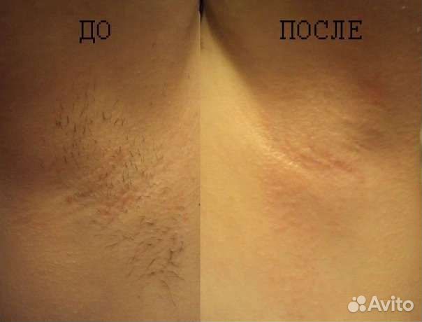 Мастер шугаринга