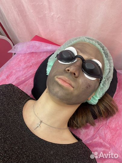 Карбоновый пилинг