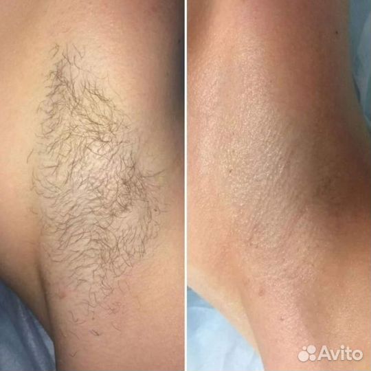 Маникюр и депиляция воском