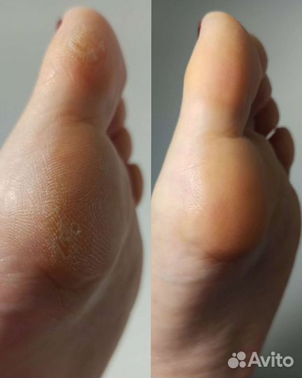 Маникюр/педикюр