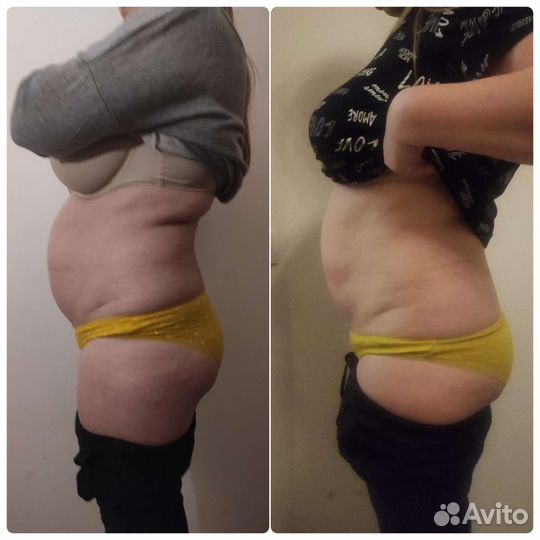 Массаж для женщин