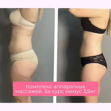 Коррекция фигуры/ вакуум
