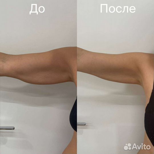 Массаж лица