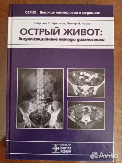 Острый живот