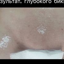 Шугаринг депиляция, Чита