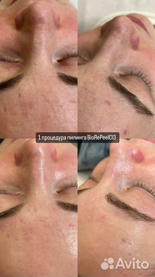 Услуги косметолога