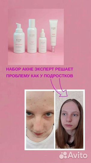 Эксперт уход