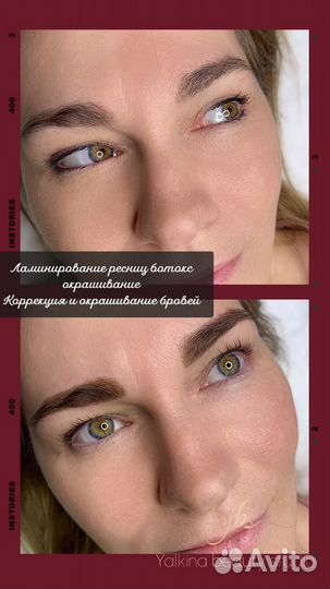 Косметолог, Шугаринг,Ламинирование ресниц и бровей