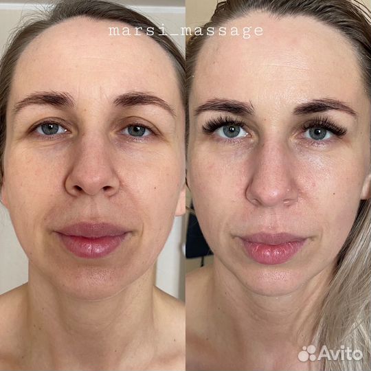 Массаж Шугаринг Новопокровская