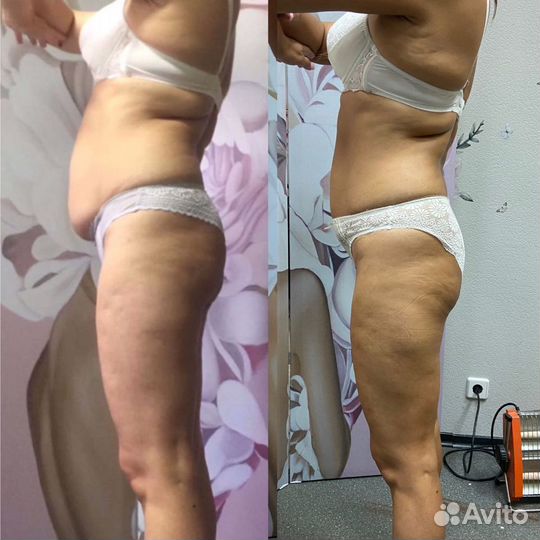 Корректирующий массаж