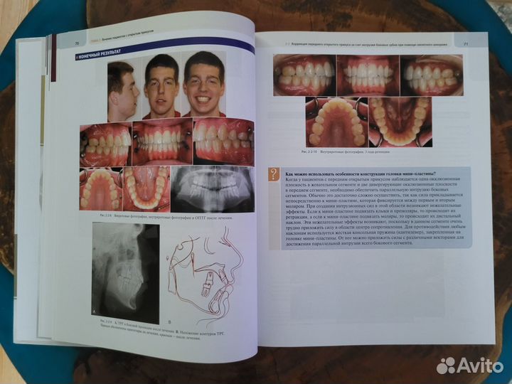 Атлас клинической ортодонтии. Р. Нанда, Ф.А. Урибе