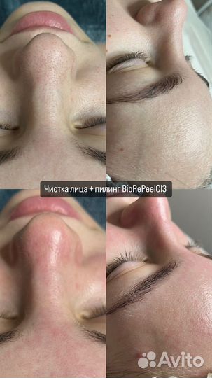 Услуги косметолога