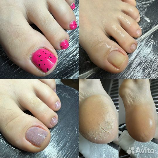 Модель на педикюр