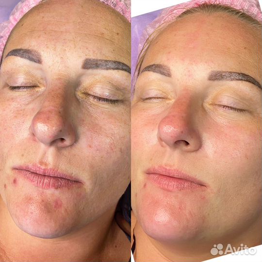 Услуги косметолога