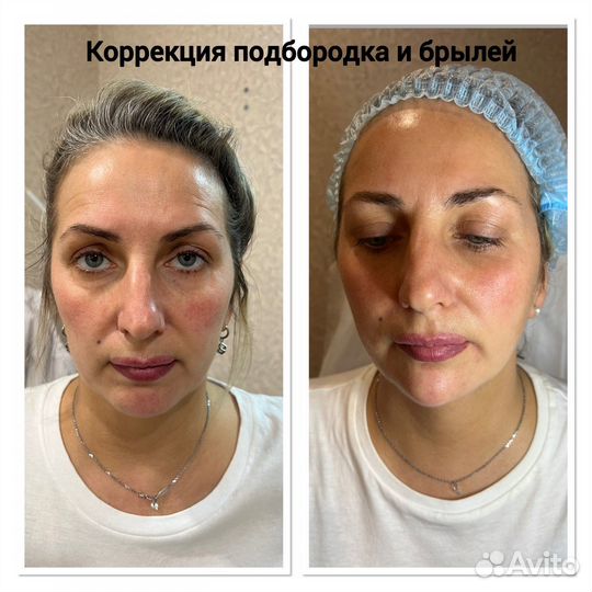 Услуги Косметолога