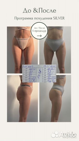 Программы похудения (Basic, Silver, Gold)