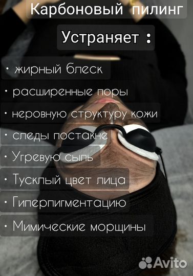 Карбоновый пилинг