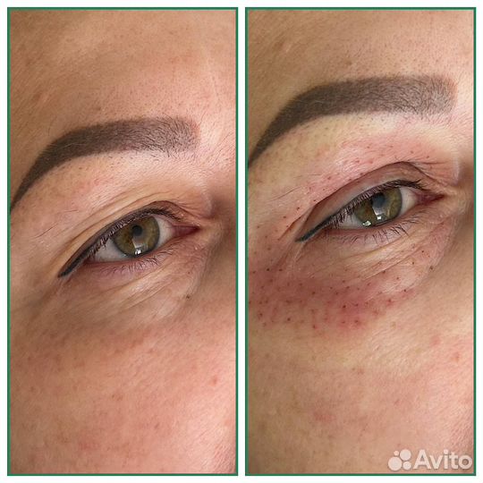 Коррекция Фигуры / Ручной массаж