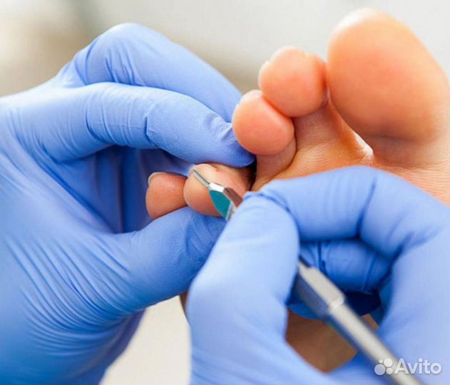 Подолог с медицинским образованием