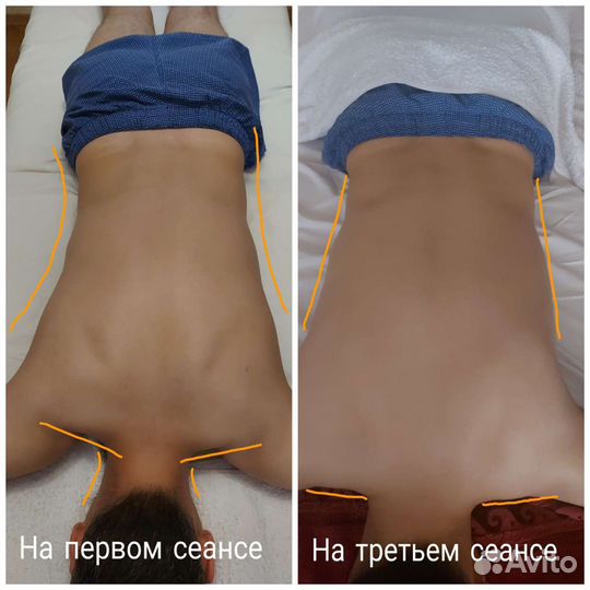 Массаж восстановительный, снятие боли