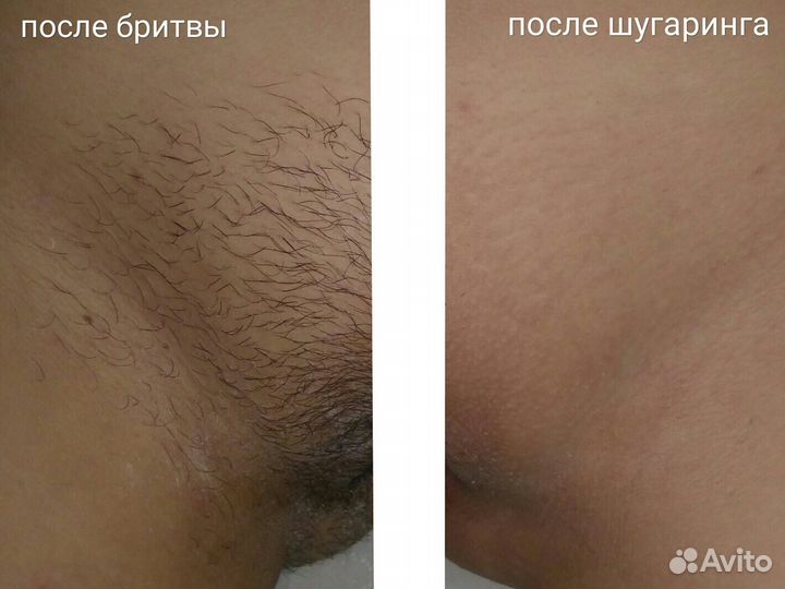 Шугаринг для девушек