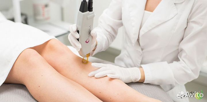 Франшиза лазерной эпиляции с высокой репутацией