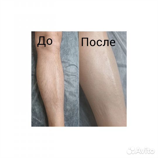 Депиляция воском