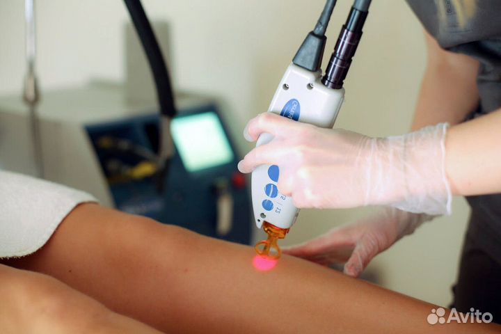 Готовый бизнес: лазерная эпиляция ждёт тебя