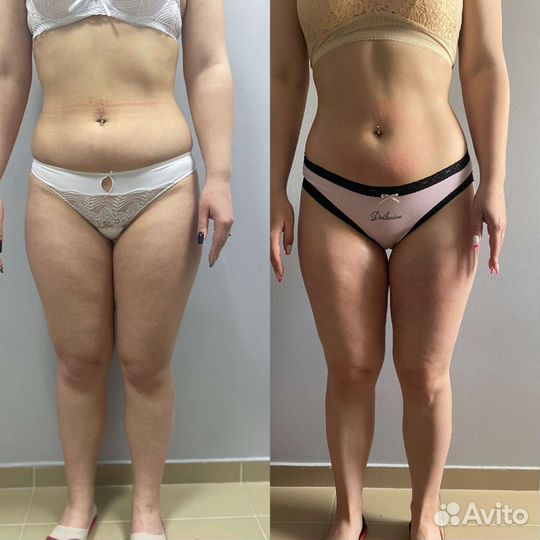 Аппаратный массаж