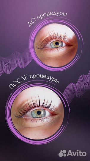 Ламинирование и ботокс ресниц