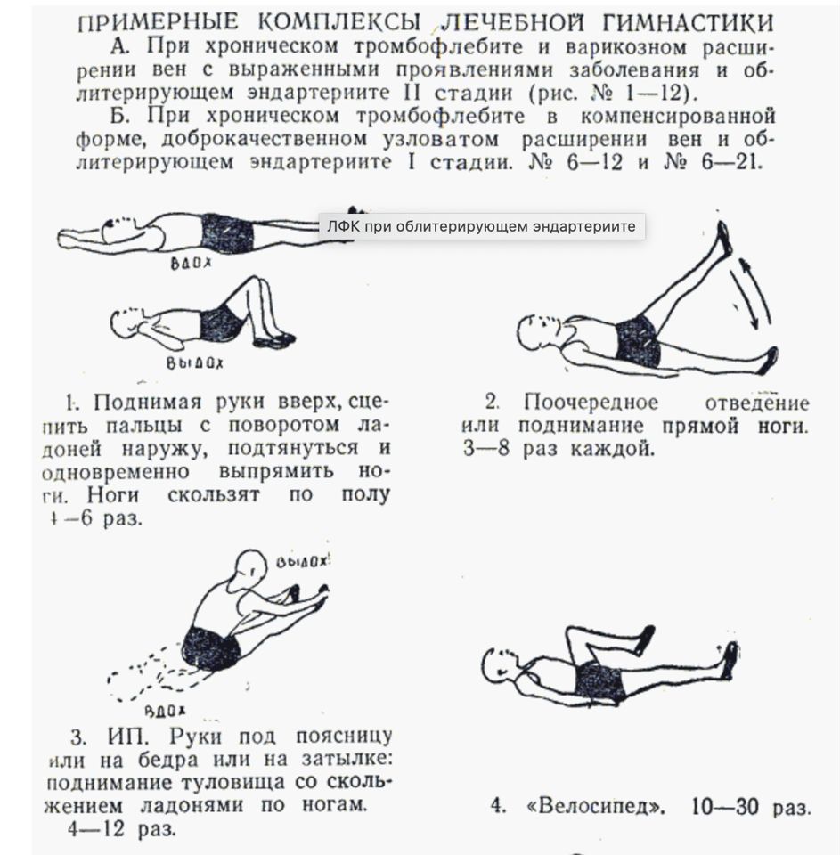 Гимнастика для конечностей ног. ЛФК при заболевании вен нижних конечностей. Упражнение ЛФК при варикозном расширении вен. Упражнения при тромбозе нижних конечностей. ЛФК при варикозе нижних конечностей комплекс упражнений.