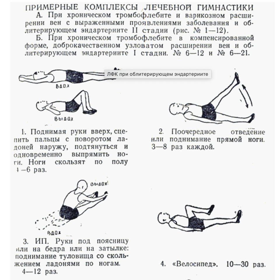 ЛФК при заболевании вен нижних конечностей. Упражнение ЛФК при варикозном расширении вен. Упражнения при тромбозе нижних конечностей. ЛФК при варикозе нижних конечностей комплекс упражнений. Упражнения при нейропатии