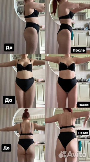 LPG массаж тело