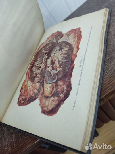 Урология. Профессор Г. Марион изд. 1931 год